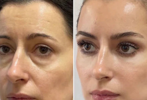 Velora™ | Anti-Wrinkle & Under-Eye Serum. Immediate Effect in 3 Minutes