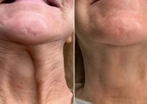 Velora™ | Anti-Wrinkle & Under-Eye Serum. Immediate Effect in 3 Minutes