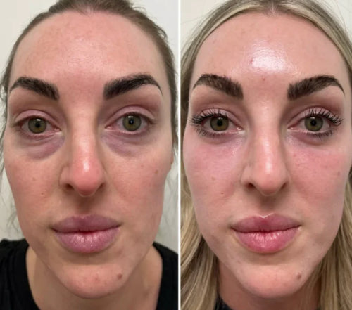 Velora™ | Anti-Wrinkle & Under-Eye Serum. Immediate Effect in 3 Minutes