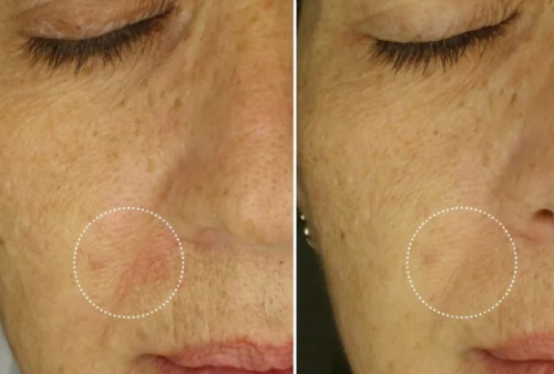 Velora™ | Anti-Falten- und Augenkonturen-Serum