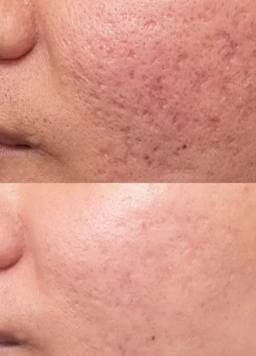 Velora Microcrystal™ Sérum Nuit Duo | Une peau plus lisse en seulement 3 à 5 nuits